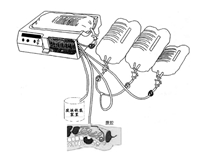 腹膜透析設(shè)備注冊審查指導(dǎo)原則（2024年修訂版）（2024年第19號(hào)）(圖1)