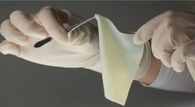 可吸收高分子材料介紹及其在植入醫(yī)療器械中的應(yīng)用(圖9) 可吸收高分子材料介紹及其在植入醫(yī)療器械中的應(yīng)用(圖9)